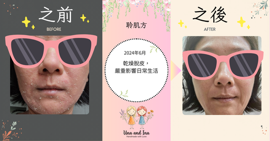 2024年6月（女士，濕疹）
