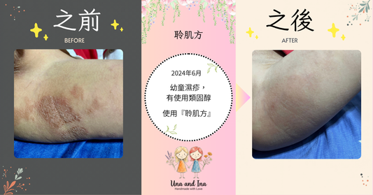 2024年5月（幼童濕疹，有使用類固醇）