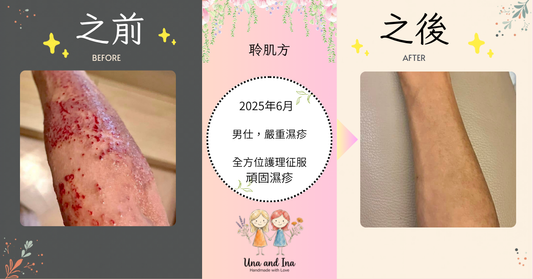 征服頑強濕疹：從傷口發炎到重建肌膚防禦盾