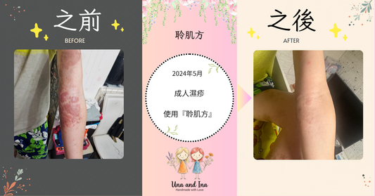 濕疹「根治」的希望：量膚定制，告別無效嘗試