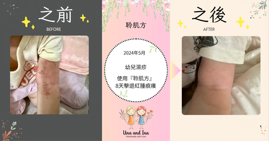 2024年5月（幼兒濕疹）