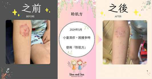2024年4月（小童濕疹，困擾多時）