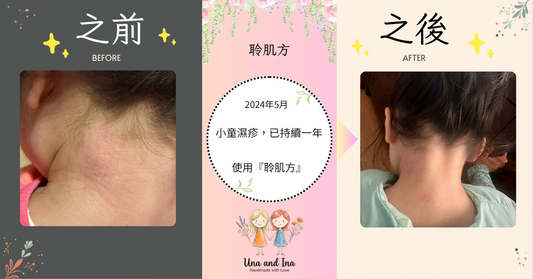 2024年4月（小童濕疹，已持續一年）國外訂單