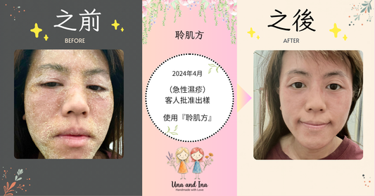 2024年4月（急性濕疹）客人批准出樣。