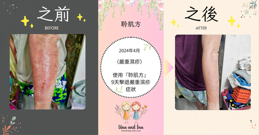 2024年4月（嚴重濕疹）