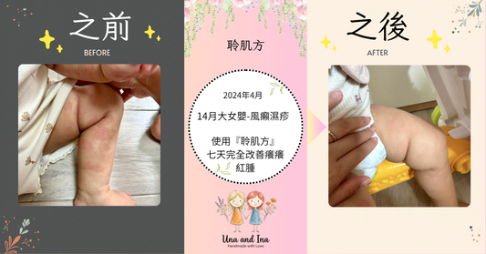 2024年4月（14月大女嬰-風癩濕疹）
