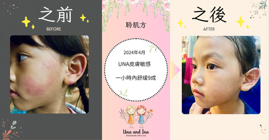 2024年3月（UNA皮膚敏感）