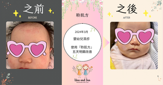 2024年3月（嬰幼兒濕疹）