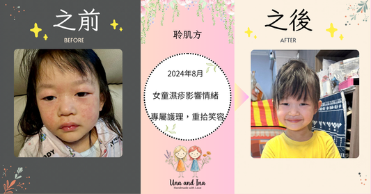 告別敏感濕疹：見證專屬護理帶來的笑容轉變