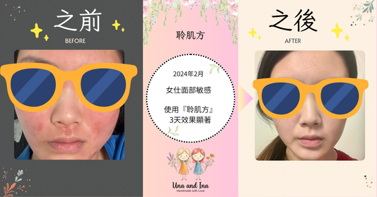 2024年2月（面部皮膚敏感）