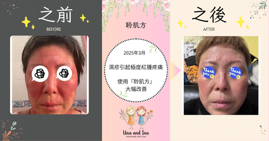 2025-3月（濕疹引起極度紅腫疼痛）