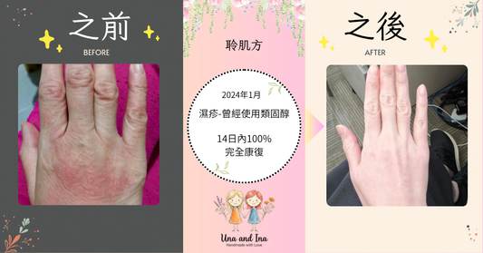 2024年1月(濕疹-曾經使用類固醇）