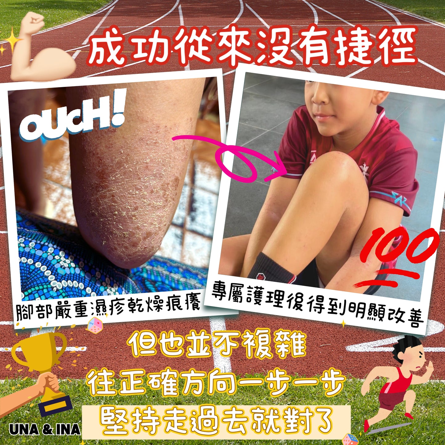 全方位濕疹護理七步曲優惠套裝