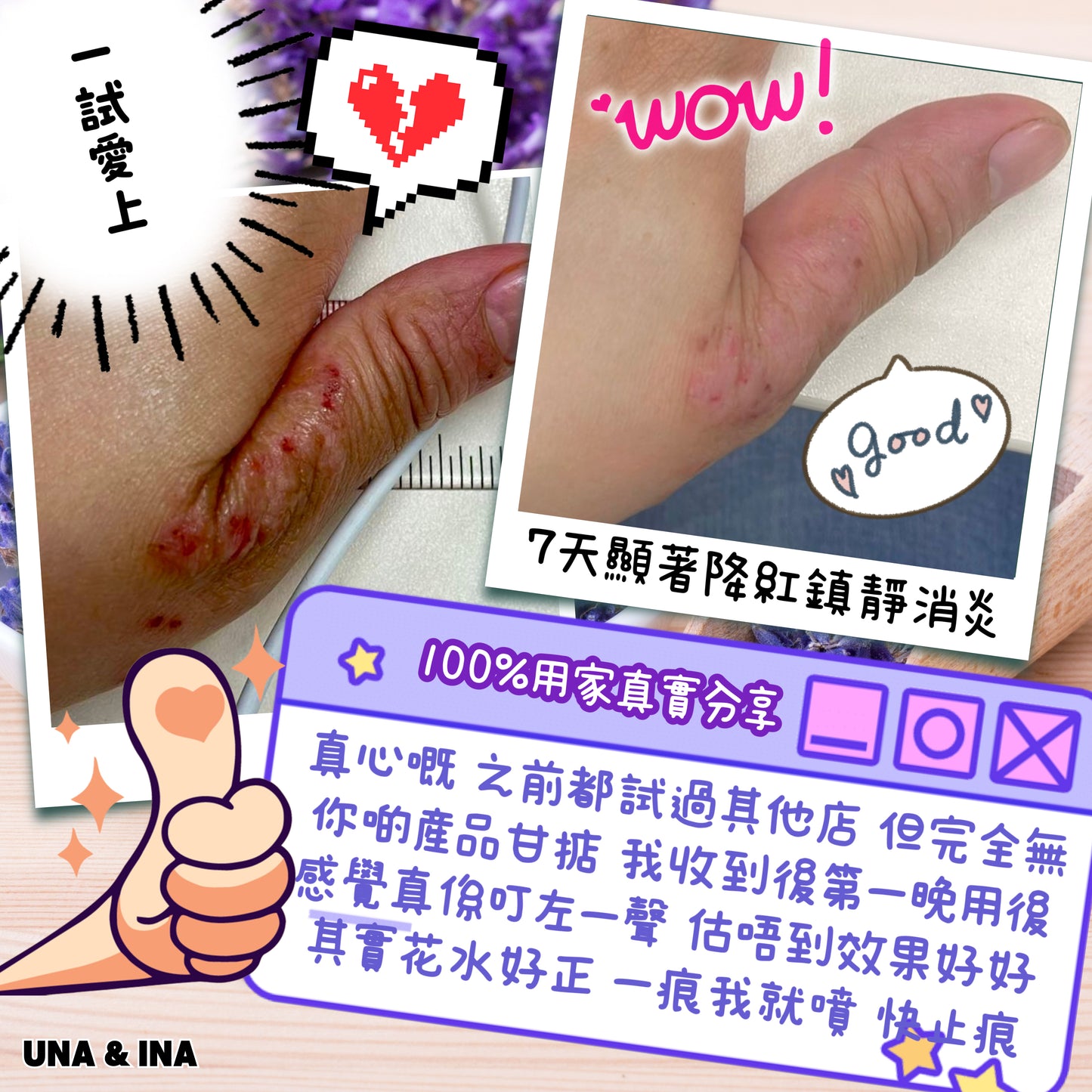 全方位濕疹護理七步曲優惠套裝