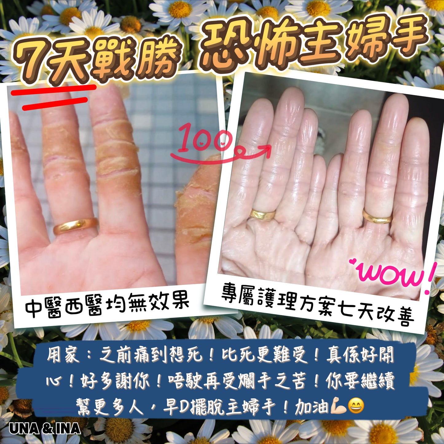 全方位濕疹護理七步曲優惠套裝