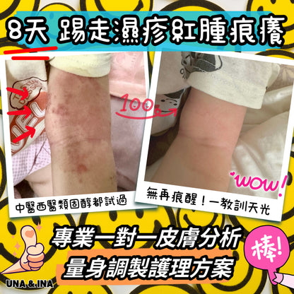全方位濕疹護理七步曲優惠套裝