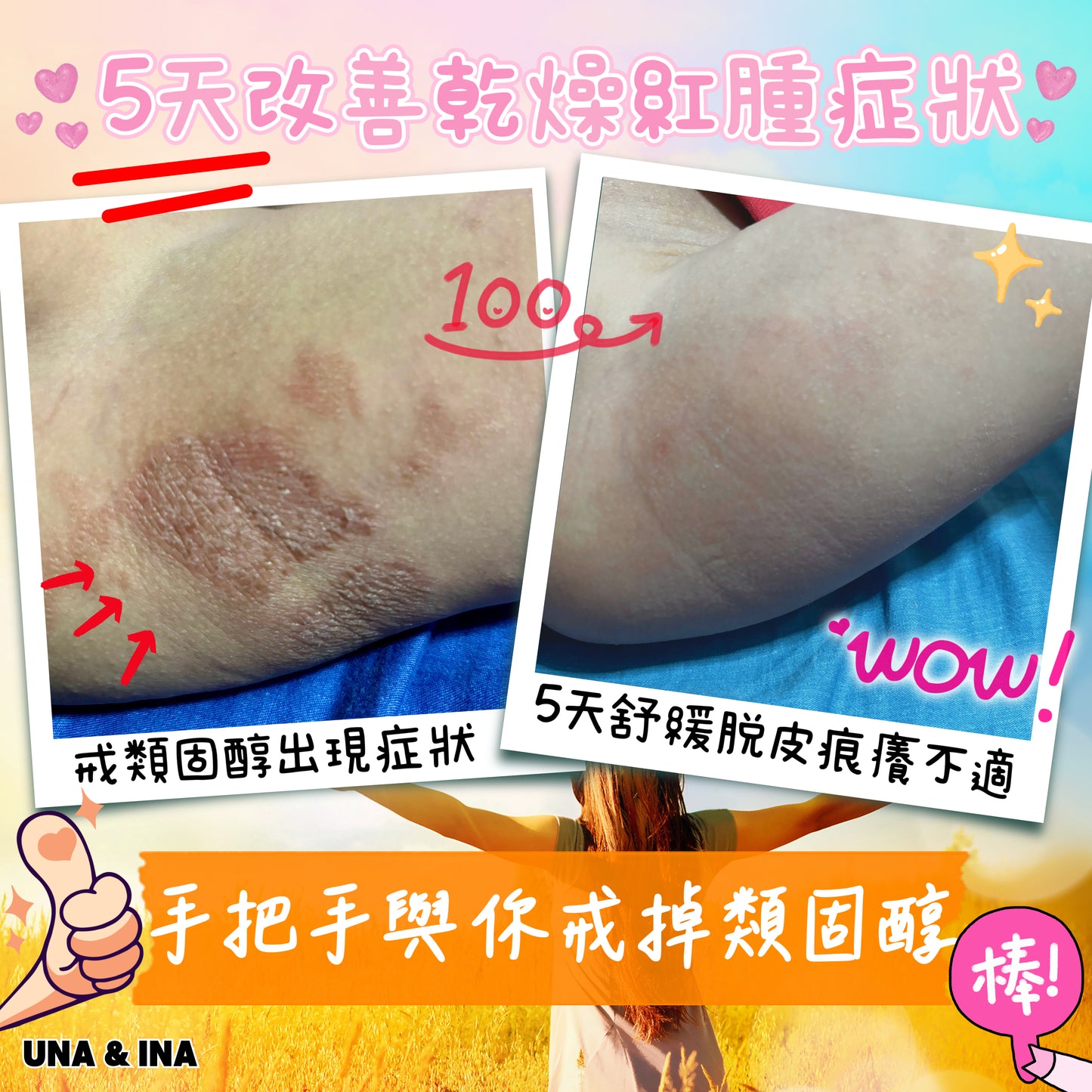 全方位濕疹護理七步曲優惠套裝