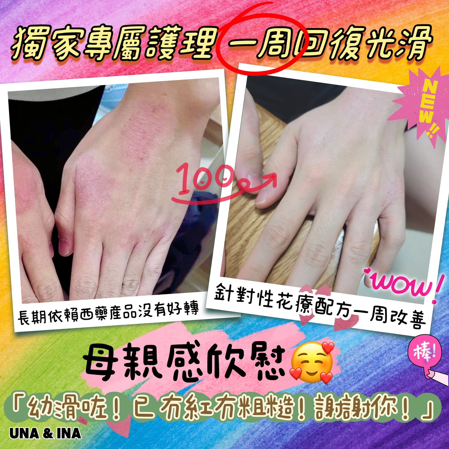 全方位濕疹護理七步曲優惠套裝