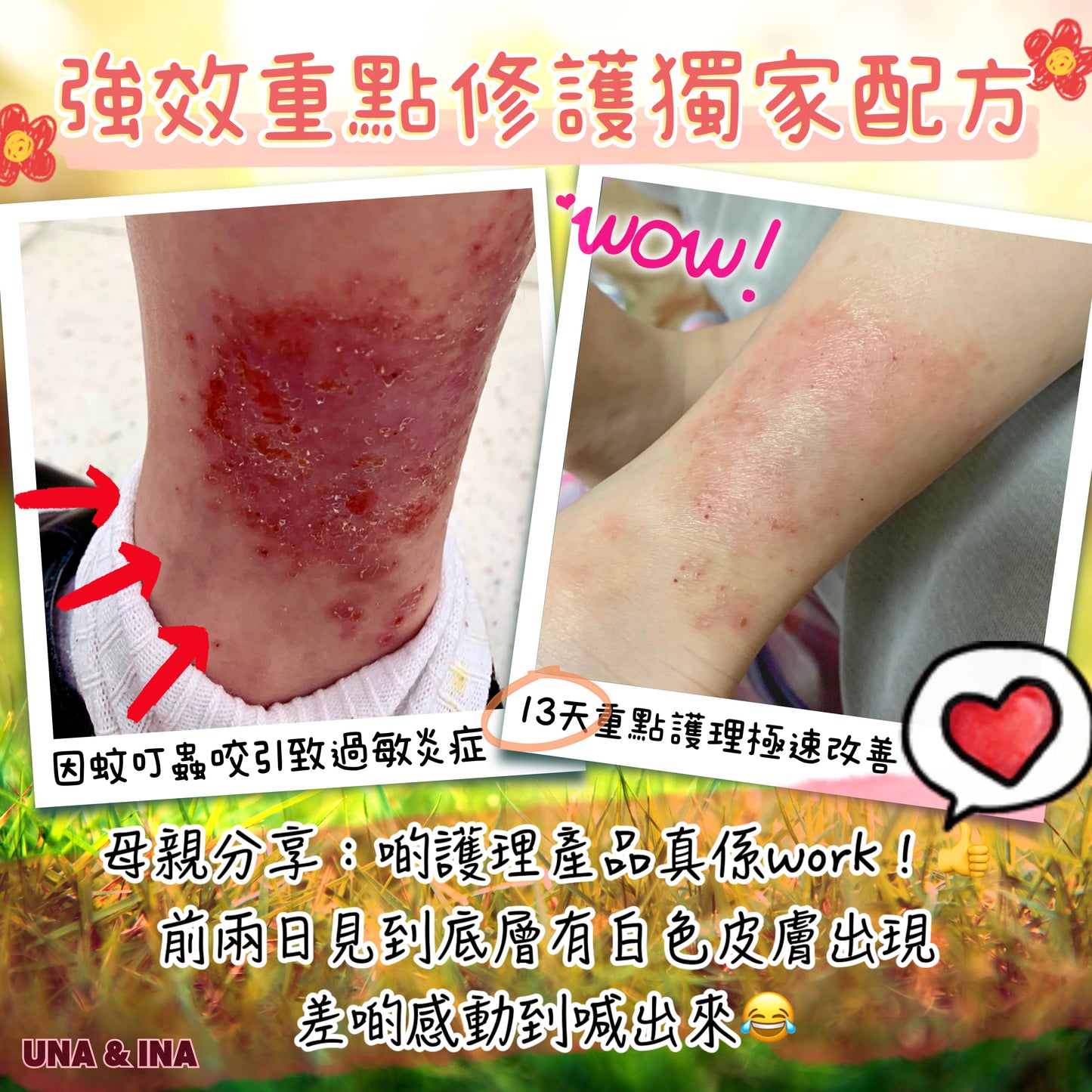 全方位濕疹護理七步曲優惠套裝