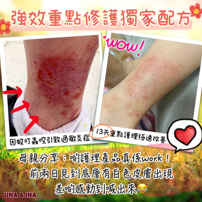 全方位濕疹護理七步曲優惠套裝