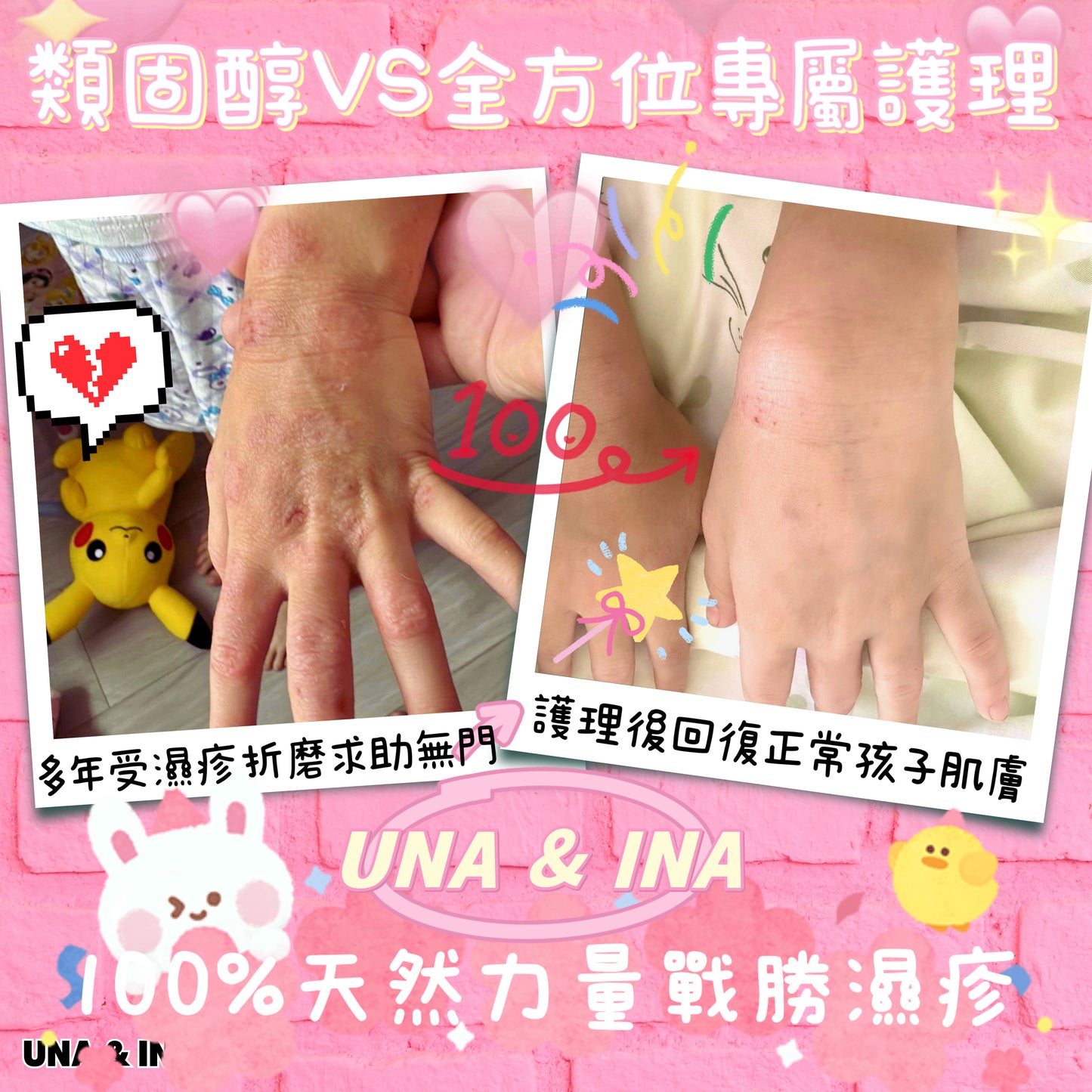 全方位濕疹護理七步曲優惠套裝