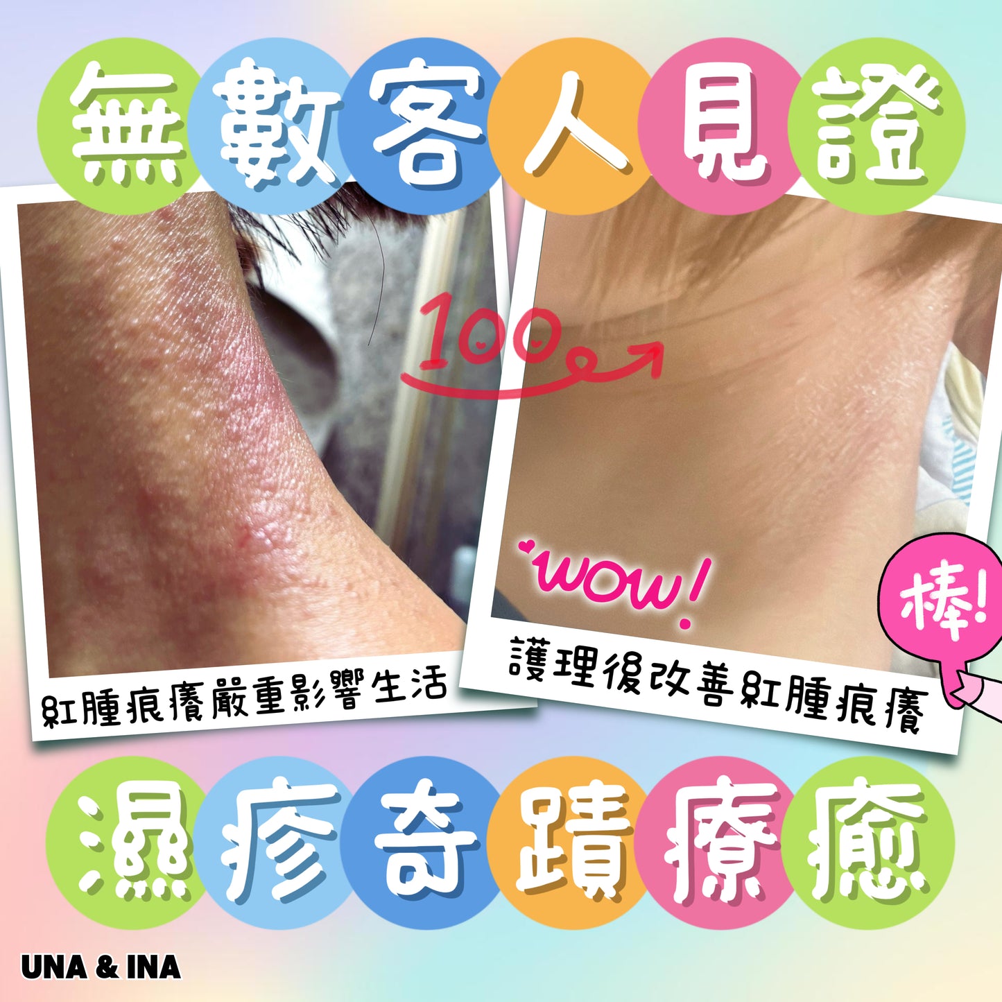 全方位濕疹護理七步曲優惠套裝