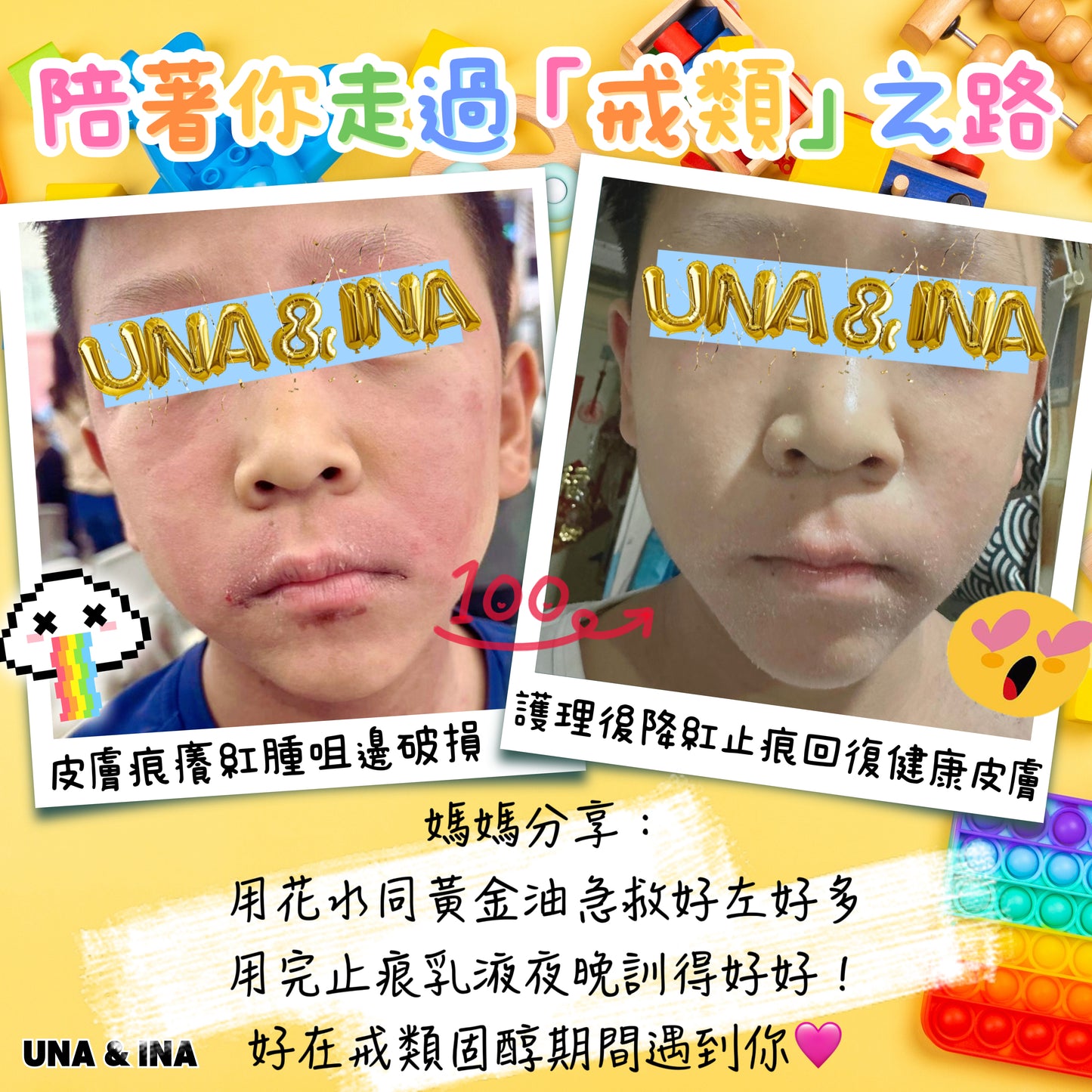 全方位濕疹護理七步曲優惠套裝