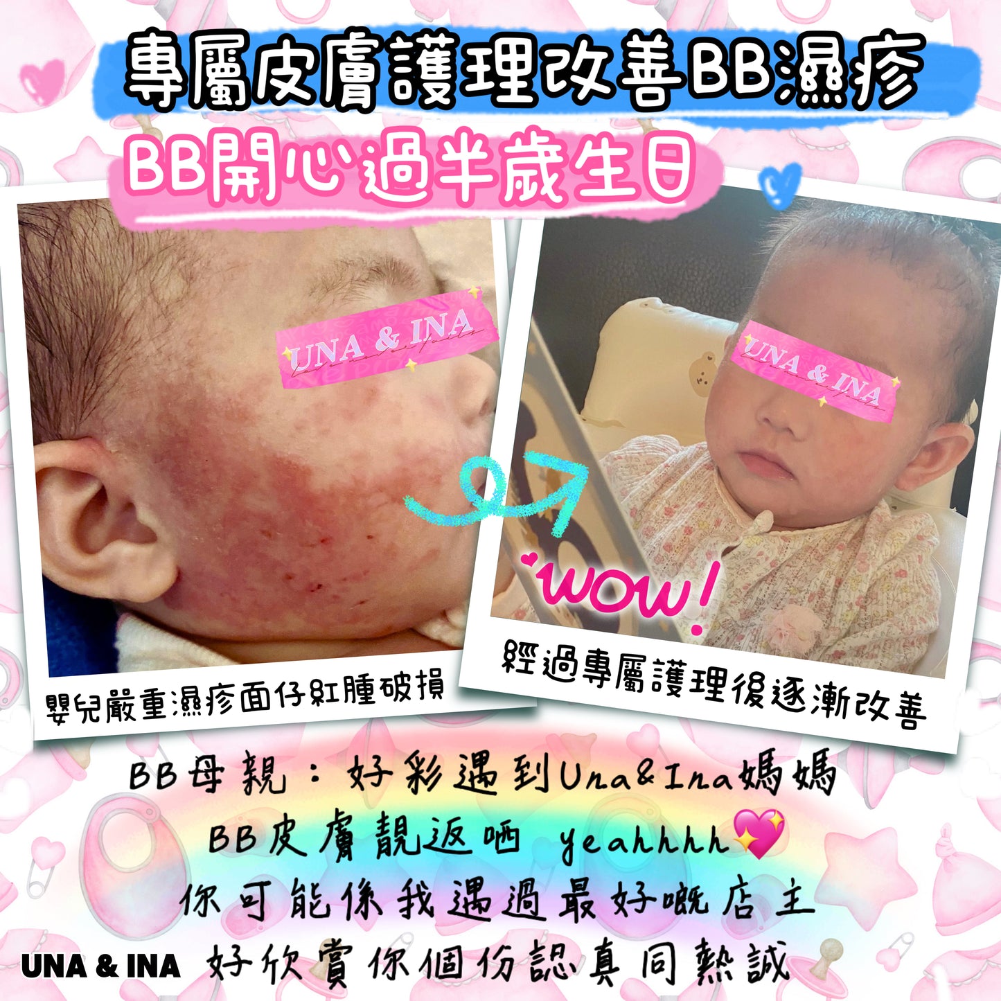 全方位濕疹護理七步曲優惠套裝