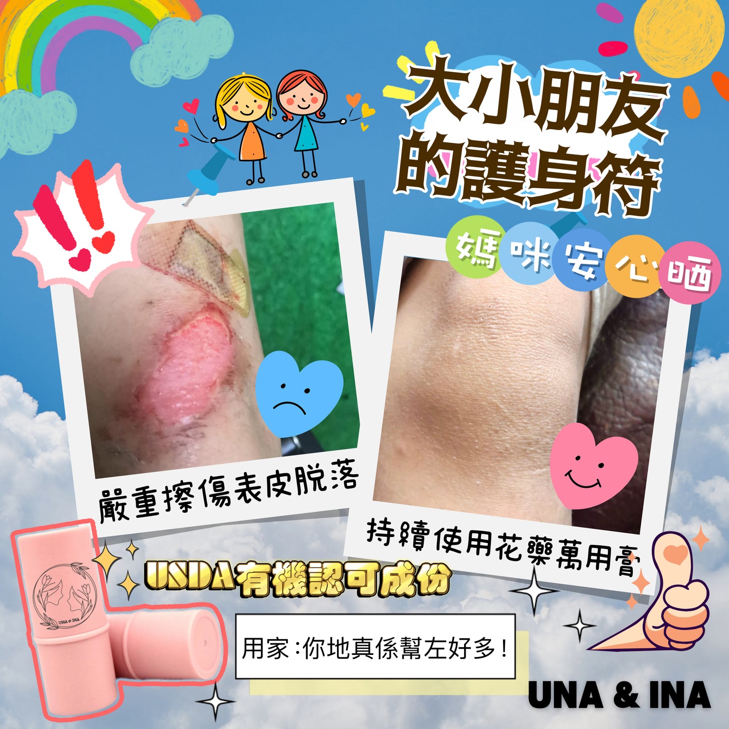 兒童花藥萬用膏