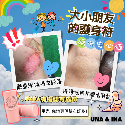 兒童花藥萬用膏