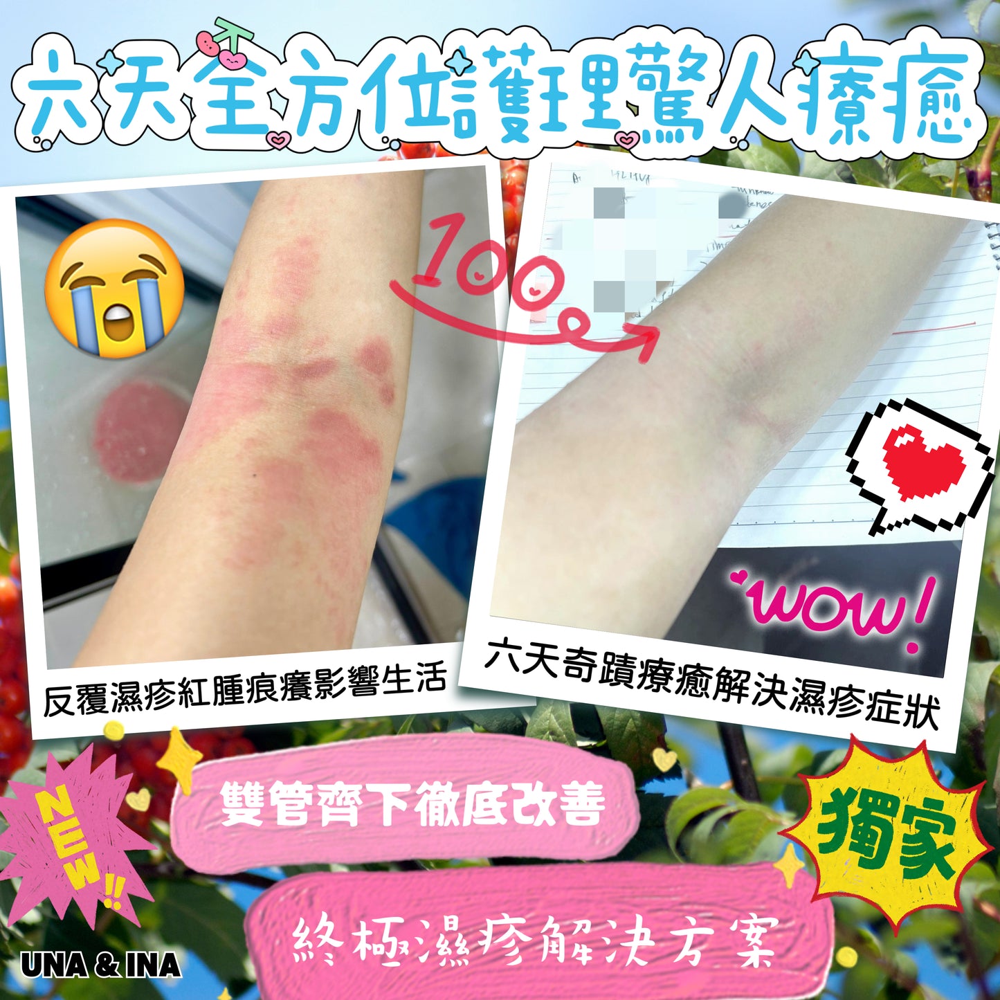 全方位濕疹護理七步曲優惠套裝