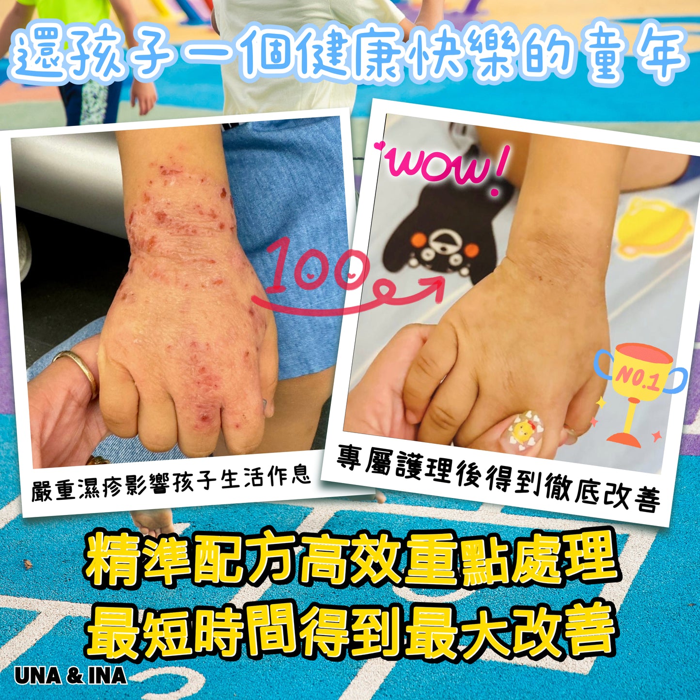 印度苦楝速效止痕乳液（嬰幼兒適用）- Step1