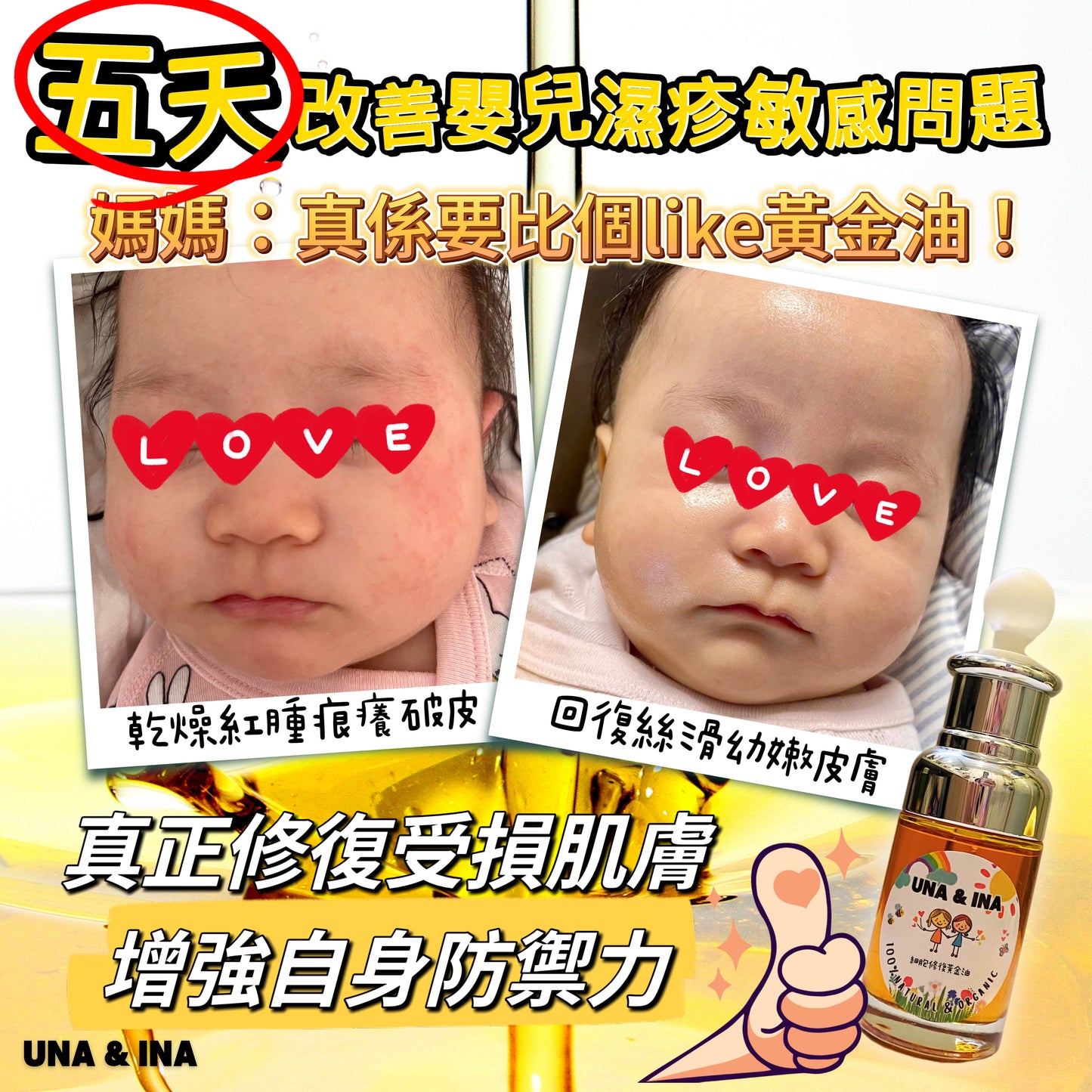 全方位濕疹護理七步曲優惠套裝