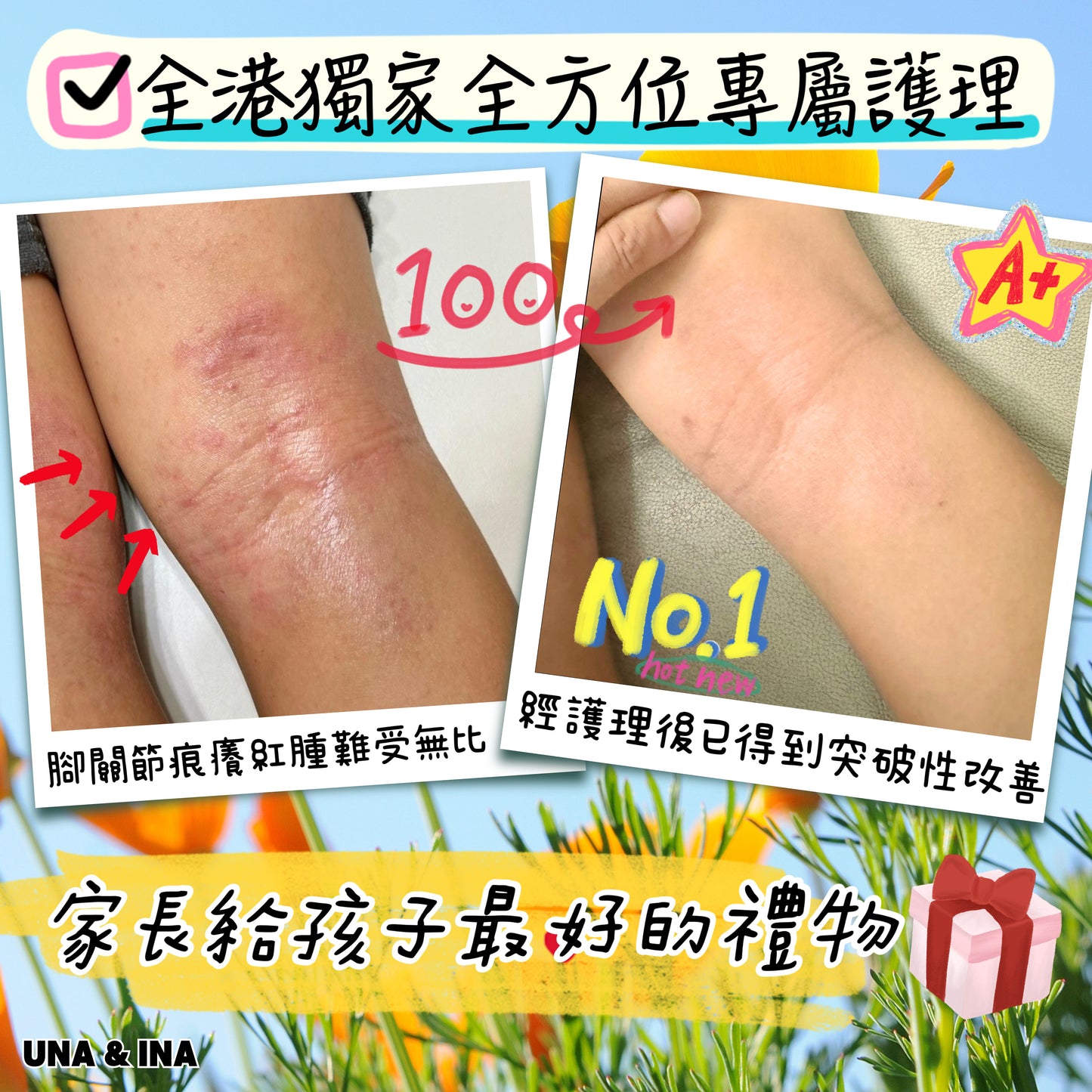 舒緩濕疹潤膚乳（嬰幼兒適用）- Step2