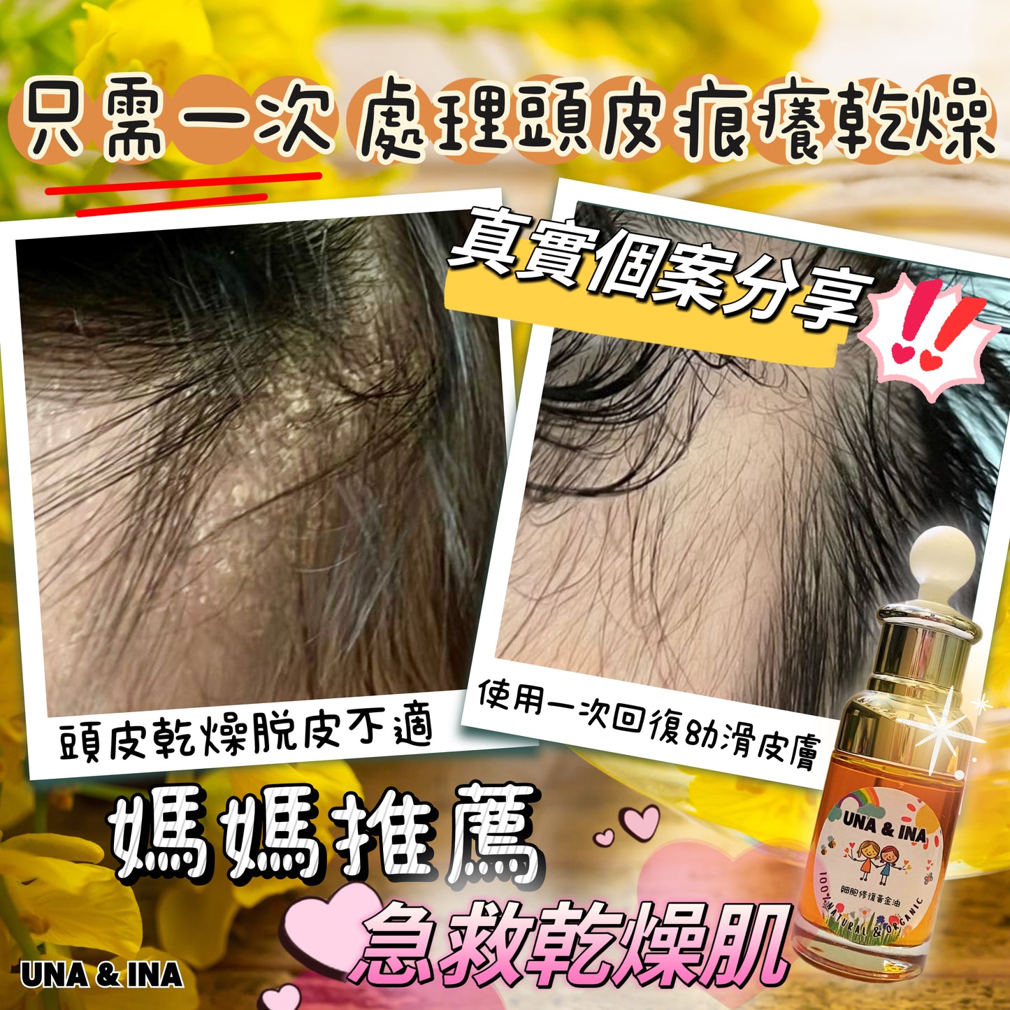 細胞修復黃金油🏵️