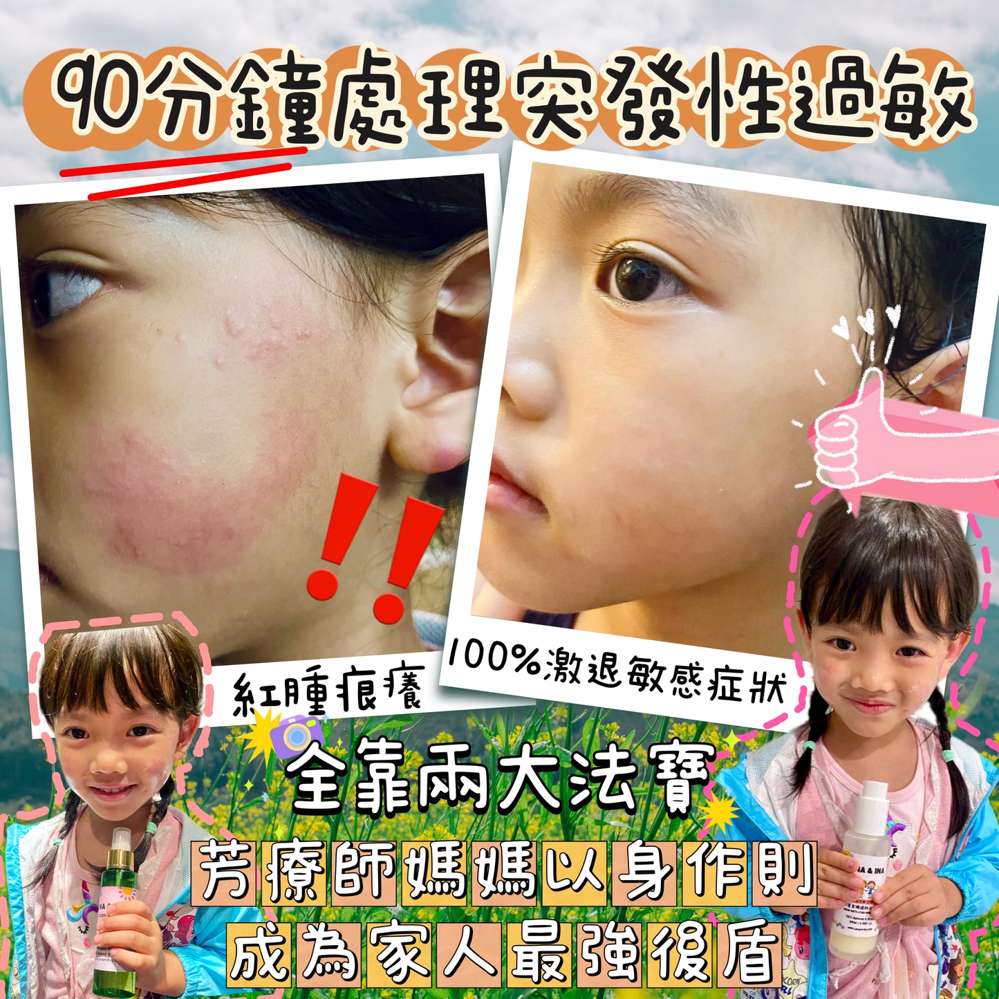 全方位濕疹護理七步曲優惠套裝