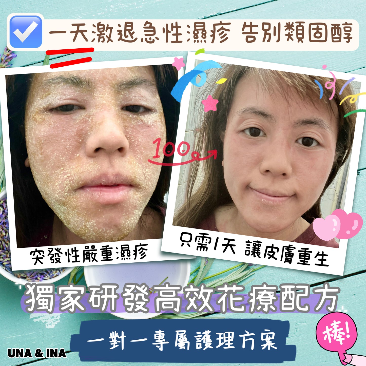 全方位濕疹護理七步曲優惠套裝