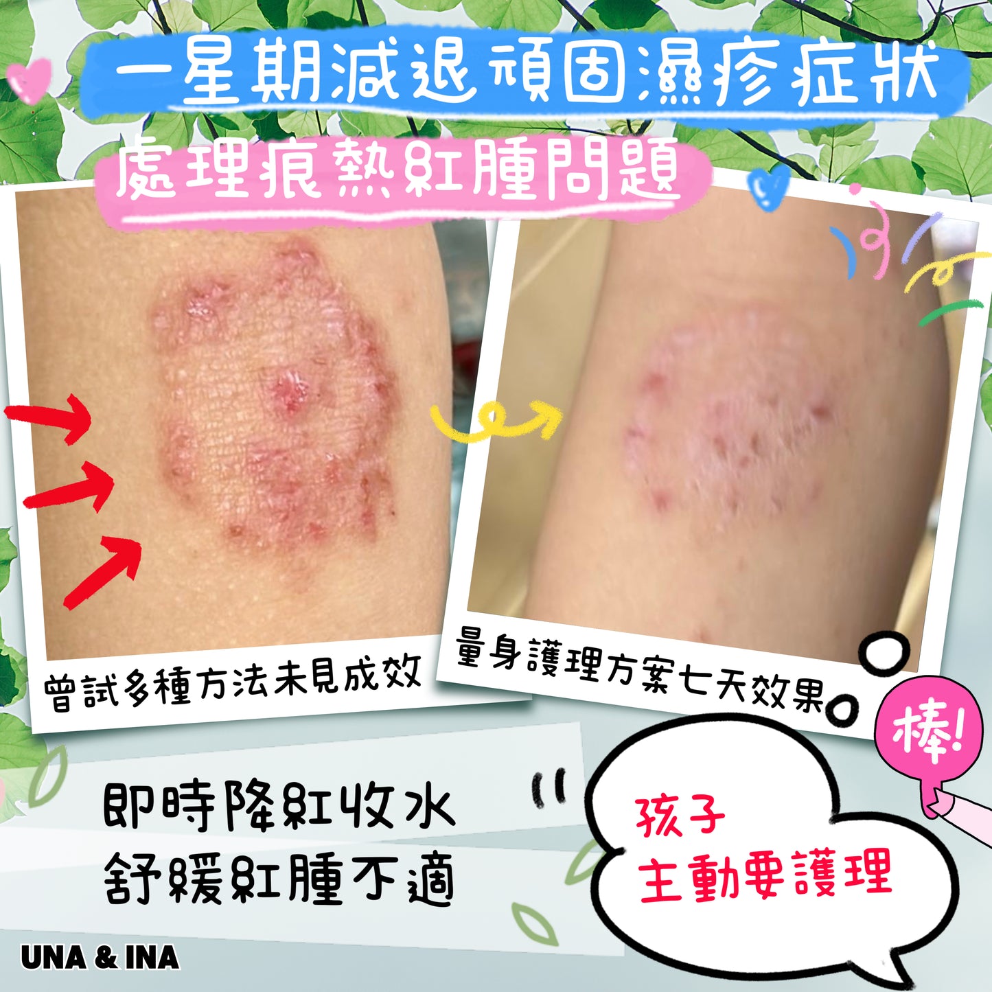 全方位濕疹護理七步曲優惠套裝